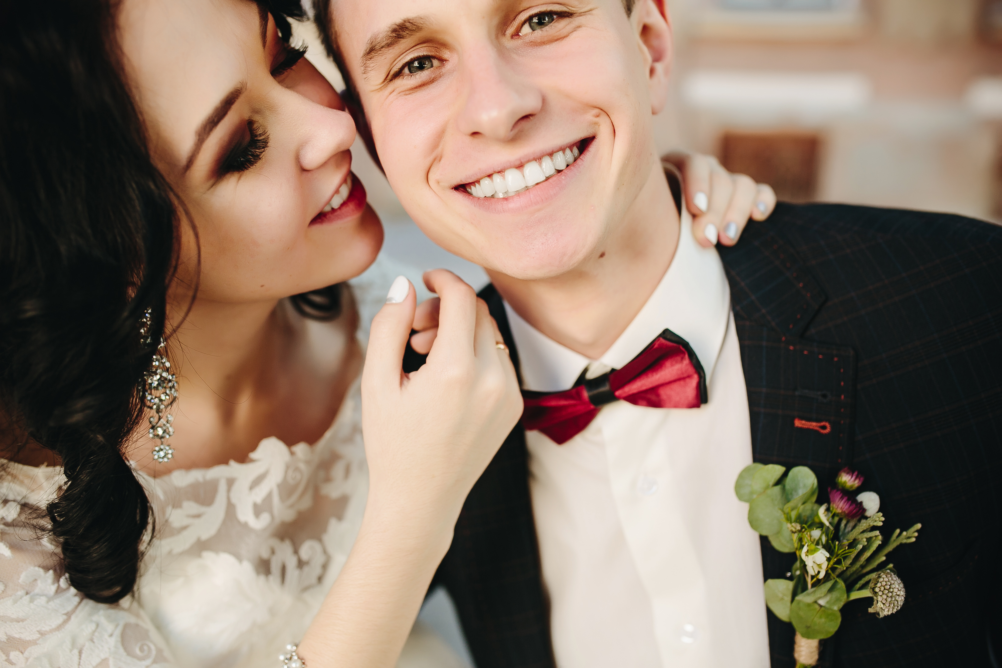 Smile Designing Before Marriage: Why You Should Plan Your Perfect Smile Early