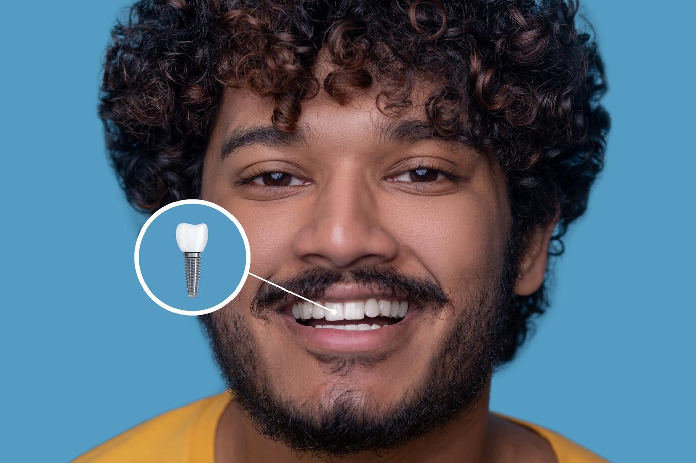 Restore Your Smile with Dental Implants in Kakkanad – Visit Smilen N Shine Complete Dental Care